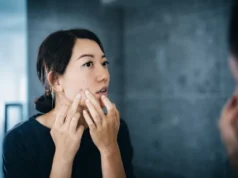 Deja de intentar tratar el acné de adultos como el de los adolescentes y haz esto en su lugar